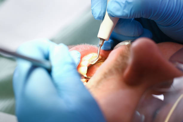 Best Emergency Treatment for Oral Infections in Strawberry, CA