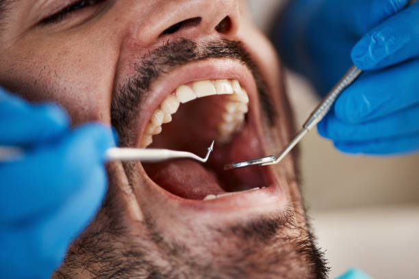 Best Emergency Dental Care for Sports Injuries in Strawberry, CA