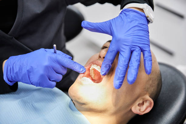 Best Emergency Denture Repair in Strawberry, CA